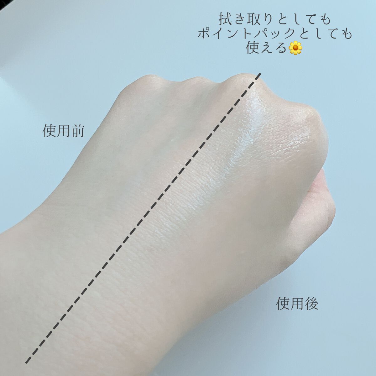 スーパーシカパッド/MEDICUBE/トナーパッドを使ったクチコミ(7枚目)