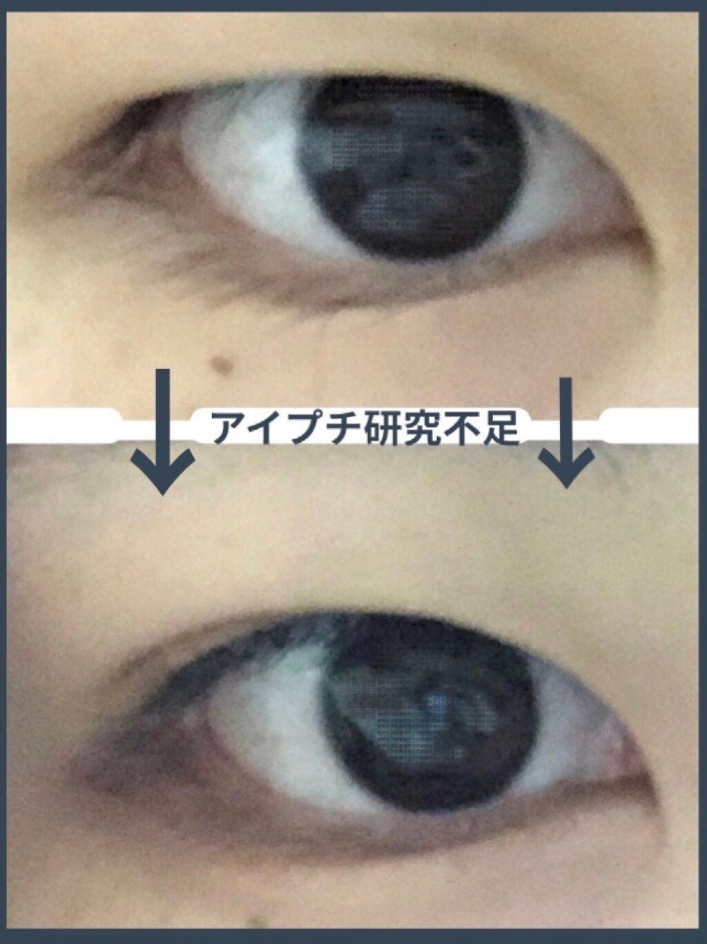 アイトーク/アイトーク/二重まぶた用アイテムを使ったクチコミ(1枚目)