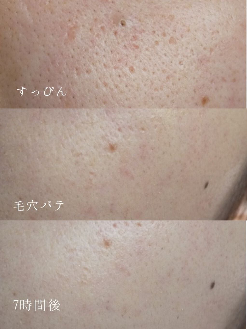 ミネラルBBクリーム NM(ナチュラルマット)/毛穴パテ職人/BBクリームを使ったクチコミ(2枚目)