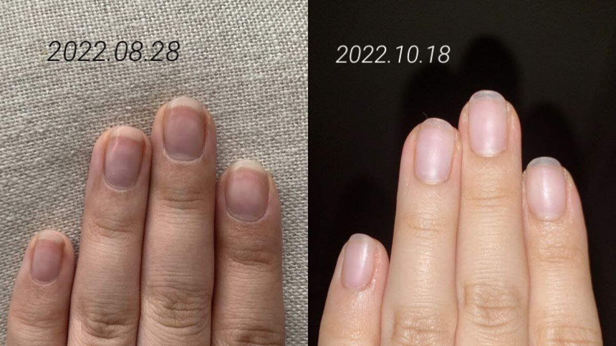 キューティクルオイル/ネイルホリック/ネイルオイル・トリートメントを使ったクチコミ（2枚目）