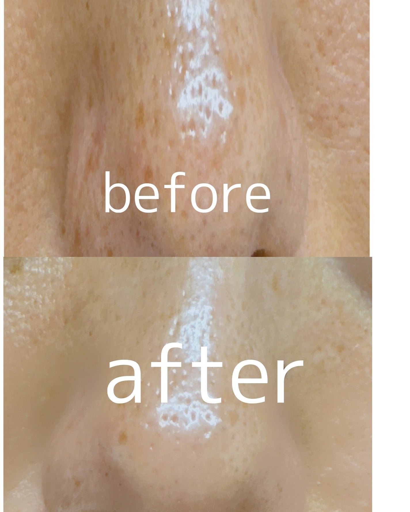 ラクトソイセバム&ブラックヘッドクレンジングオイル/SOME BY MI/オイルクレンジングを使ったクチコミ(5枚目)