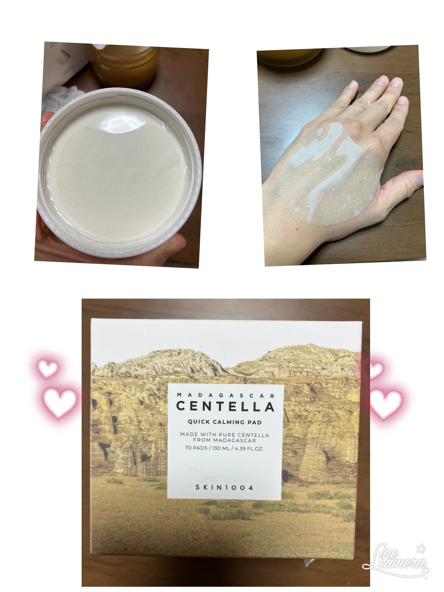 センテラ クイックカーミングパッド/SKIN1004/トナーパッドを使ったクチコミ(1枚目)