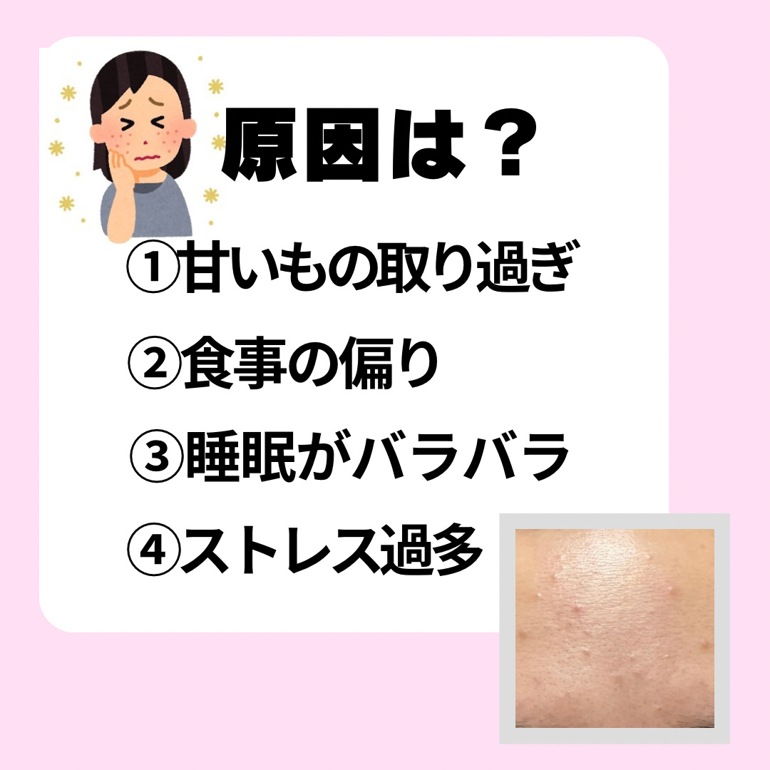 ガラクトミー スキントナー/manyo/化粧水を使ったクチコミ（2枚目）