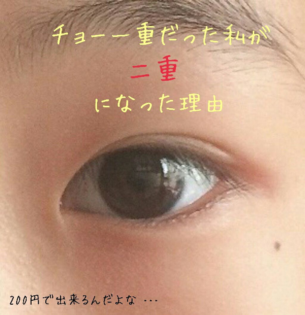 のびーるアイテープ(絆創膏タイプ、レギュラー)/DAISO/二重まぶた用アイテムを使ったクチコミ(1枚目)