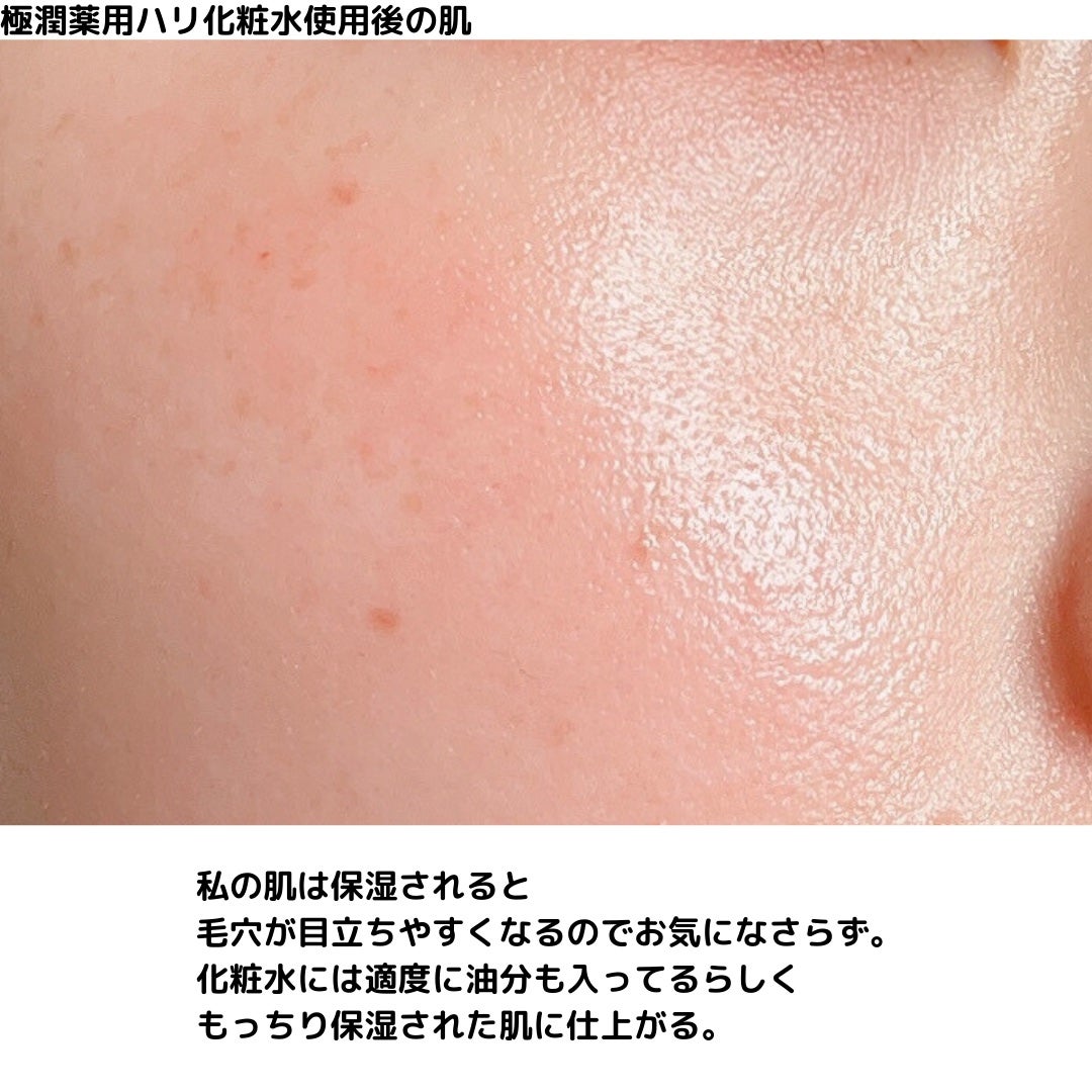 白潤プレミアム薬用浸透美白化粧水/肌ラボ/化粧水を使ったクチコミ(9枚目)