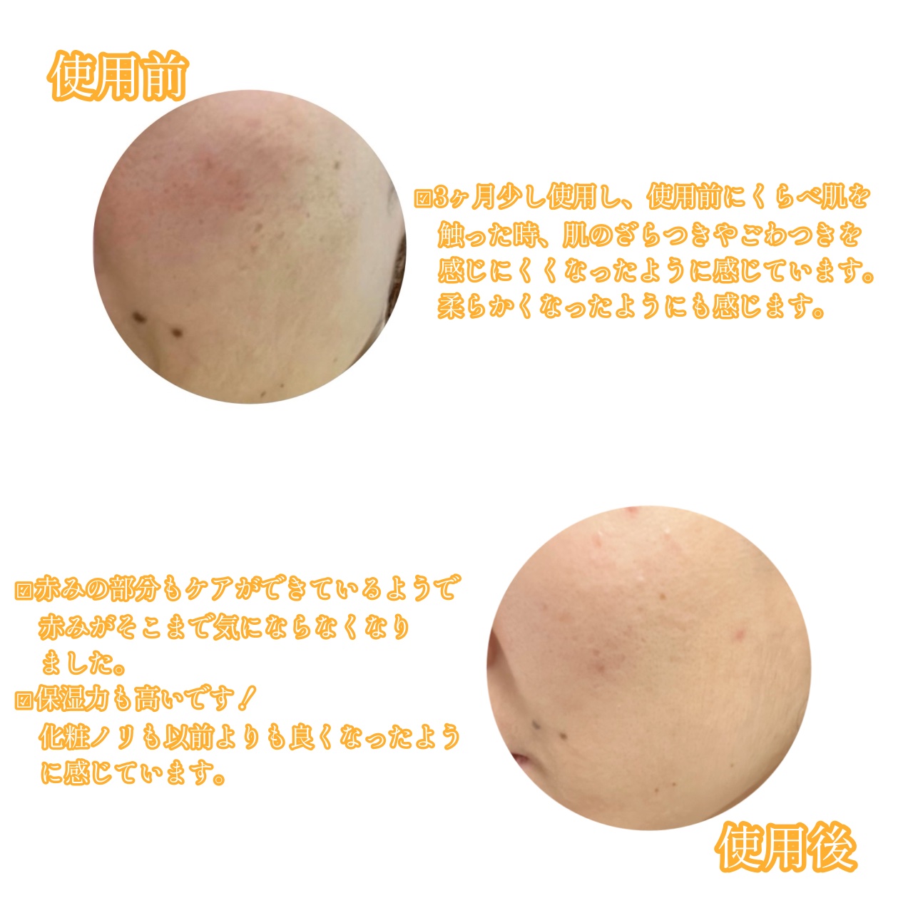 ビモラコスメ VC/BimoRa/美容液を使ったクチコミ（2枚目）