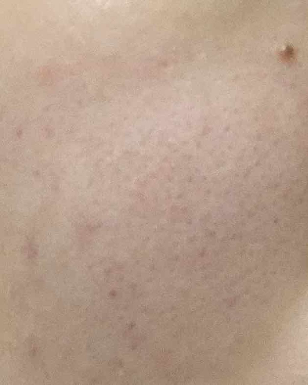 オーデュベールN/ドルックス/化粧水を使ったクチコミ(2枚目)