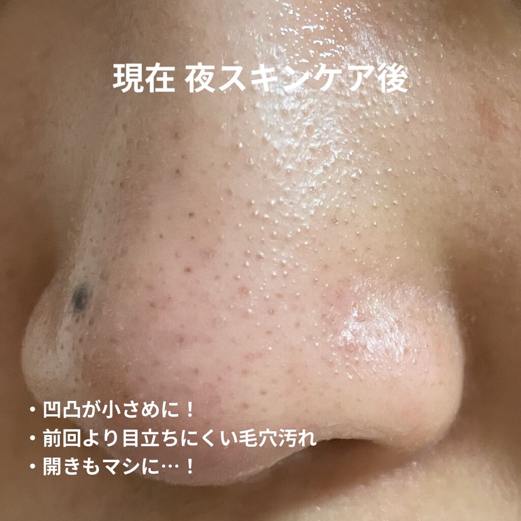 ウオーター/アベンヌ/ミスト状化粧水を使ったクチコミ（3枚目）