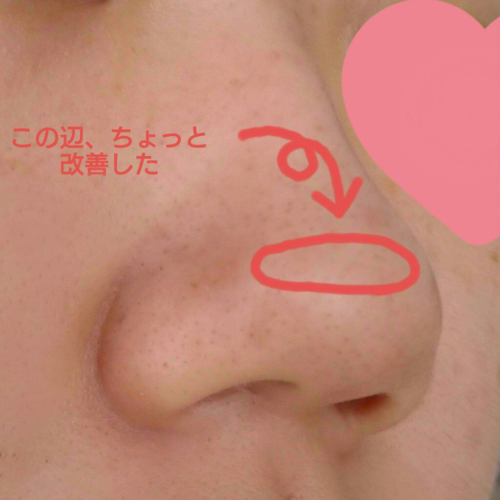 ドット・ウォッシー洗顔石鹸/ペリカン石鹸/洗顔石鹸を使ったクチコミ（2枚目）