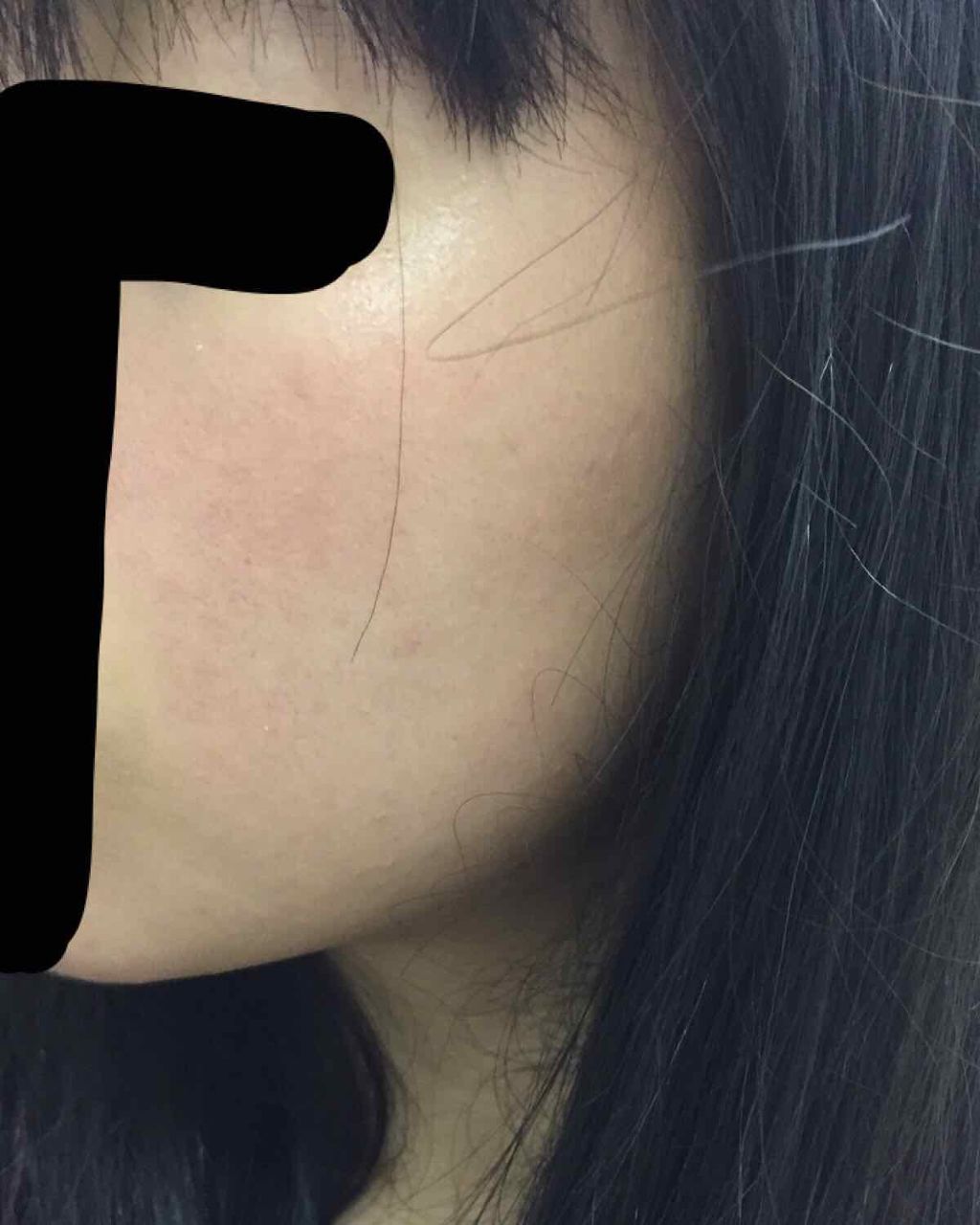 メラノCC 薬用しみ集中対策液(旧)/メラノCC/美容液を使ったクチコミ(2枚目)