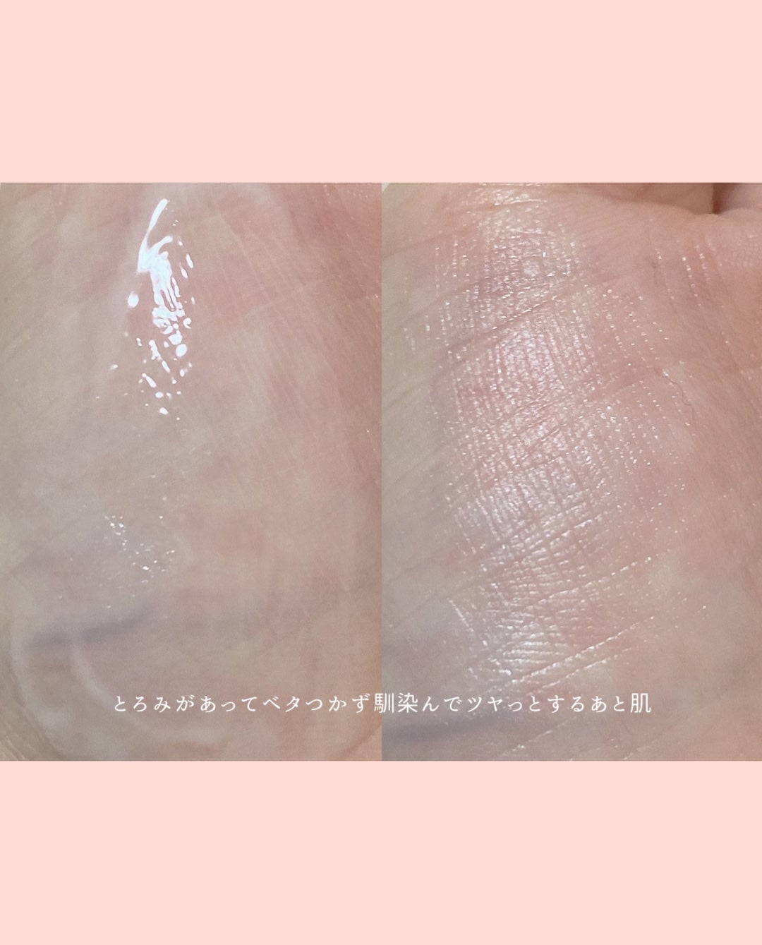 アゼペア 美容液/ネイチャーリパブリック/美容液を使ったクチコミ(4枚目)