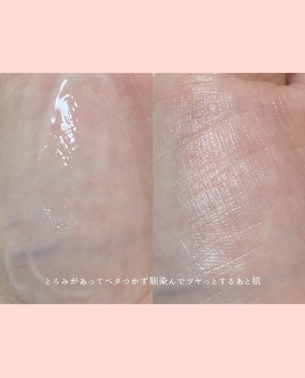 アゼペア 美容液/ネイチャーリパブリック/美容液を使ったクチコミ(4枚目)