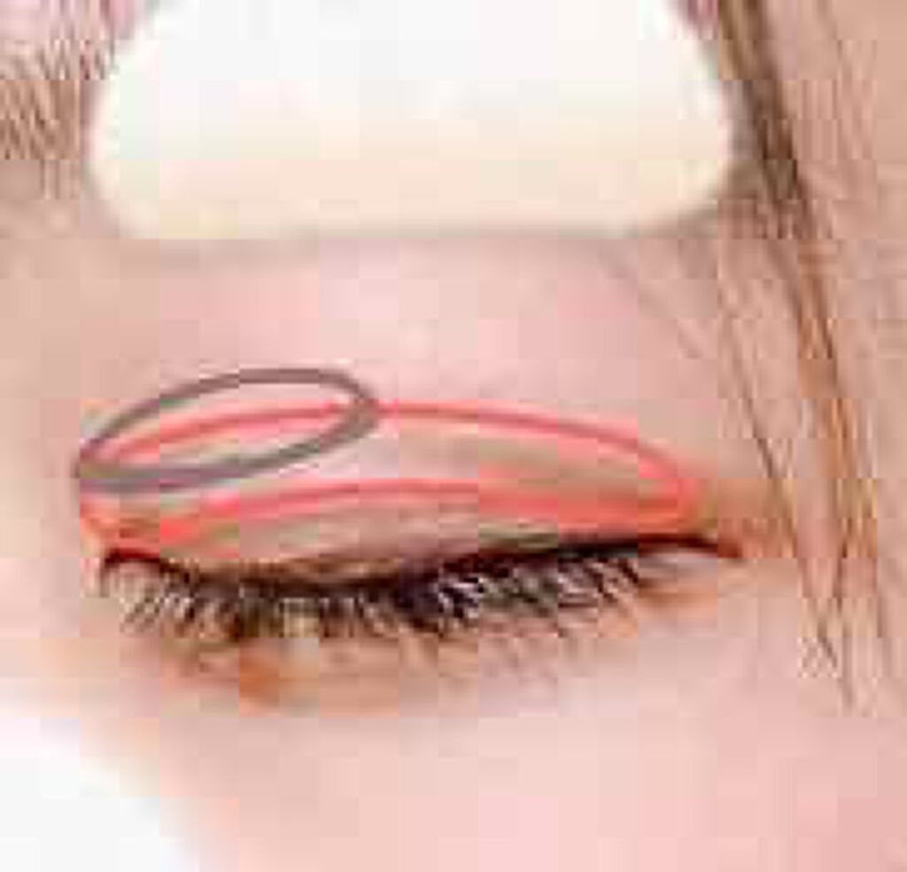 【旧品】オリシキ アイリッドスキンフィルム/D-UP/二重まぶた用アイテムを使ったクチコミ（3枚目）