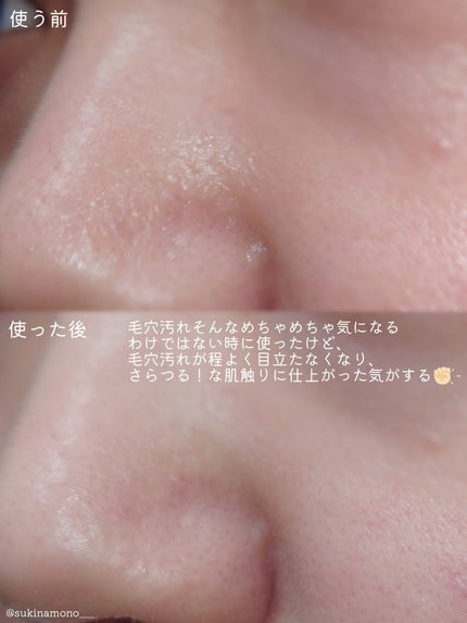 ケアナボン ひたし洗い液/小林製薬/その他スキンケアを使ったクチコミ(6枚目)