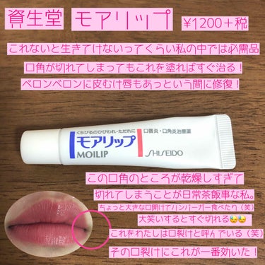 モアリップ N (医薬品)/資生堂薬品/リップケア・リップクリームを使ったクチコミ（2枚目）