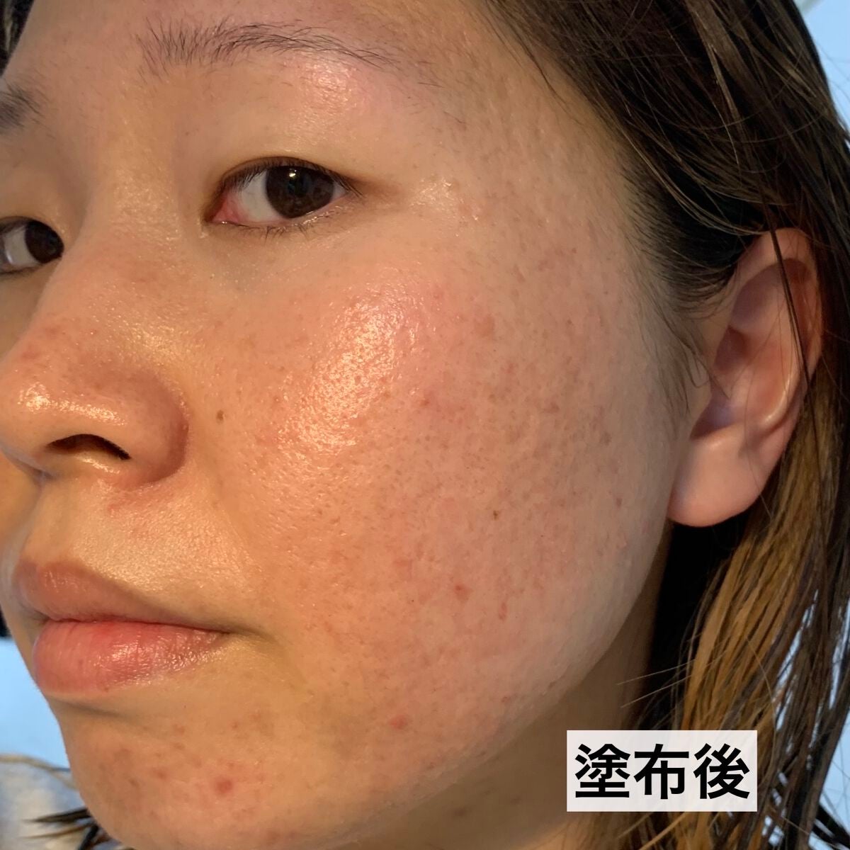 ザ ファーストエッセンス/ALBLANC/美容液を使ったクチコミ(10枚目)