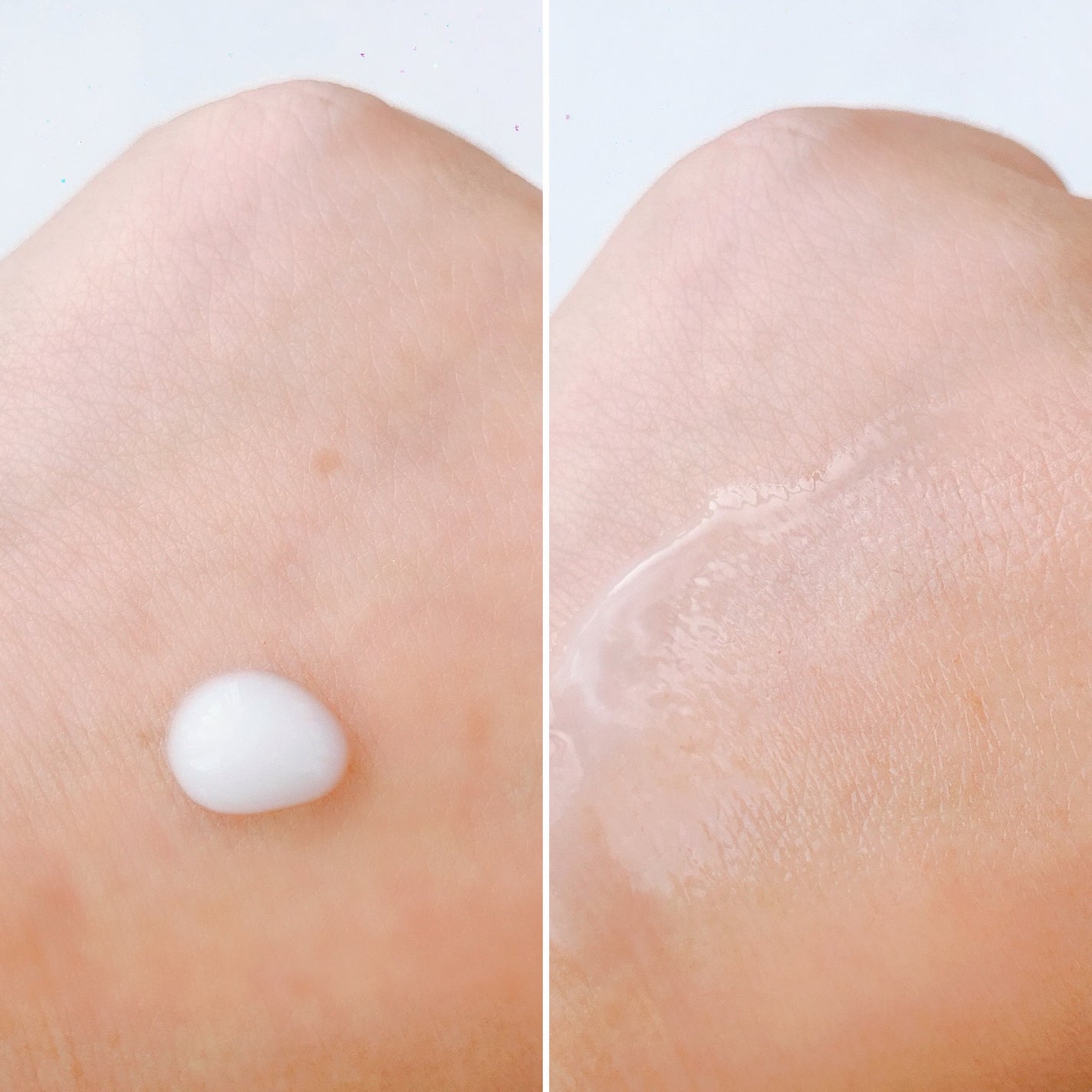 プロバイオシカ インテンシブ アンプル/SKIN1004/美容液を使ったクチコミ(4枚目)