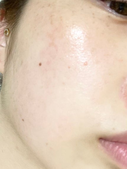 ザビタミンC23/IOPE/美容液を使ったクチコミ(3枚目)