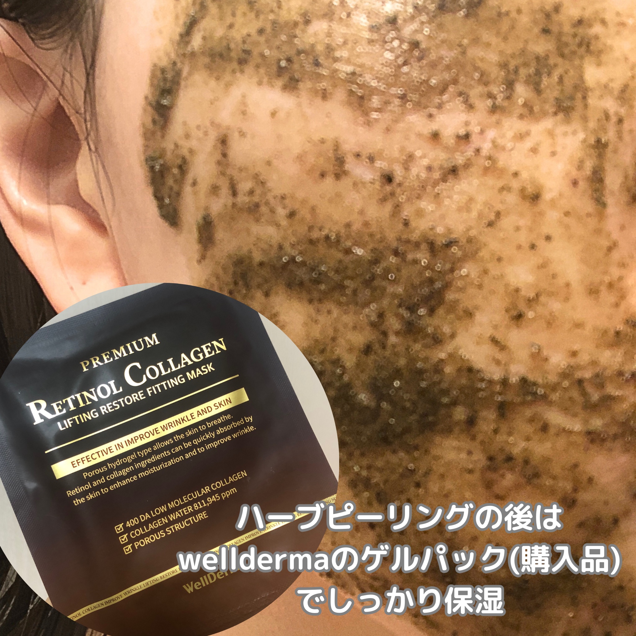 ティーツリーハーブピーリングパック/WellDerma/洗い流すパック・マスクを使ったクチコミ（3枚目）