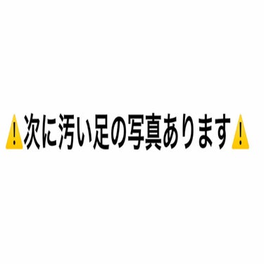 ぱーやん on LIPS 「汚い足の写真、失礼します。私はアトピー体質で、幼稚園のころから..」（1枚目）