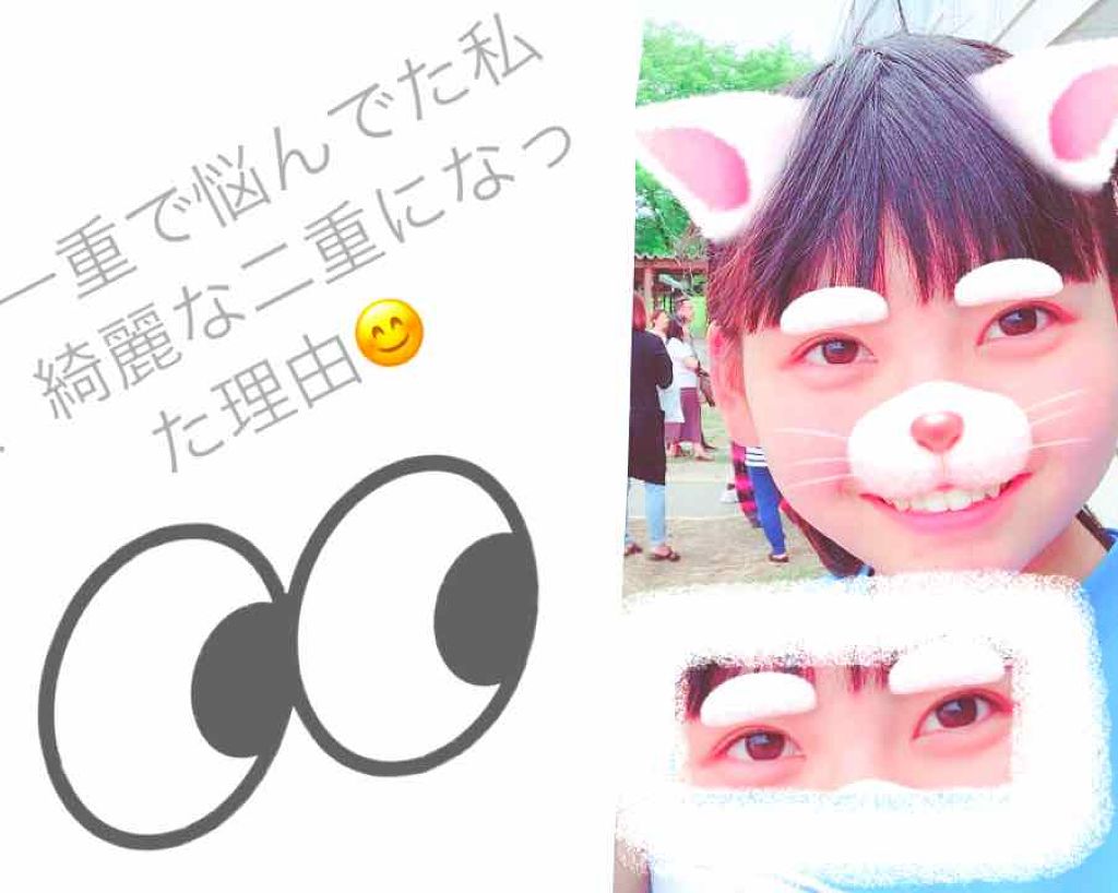 アイビューティー フィクサー WP/アストレア ヴィルゴ/二重まぶた用アイテムを使ったクチコミ（1枚目）