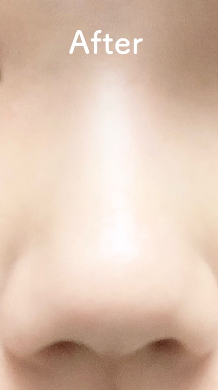 ぴゆ on LIPS 「1日たった1分半!1週間で鼻を小さくするマッサージ✼••┈┈•..」(4枚目)