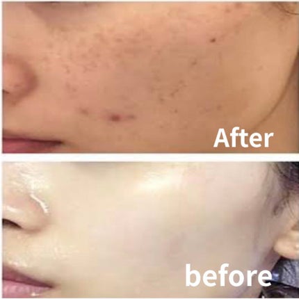 オリジナル ピュアスキンジェリー/ヴァセリン/ボディクリームを使ったクチコミ(2枚目)