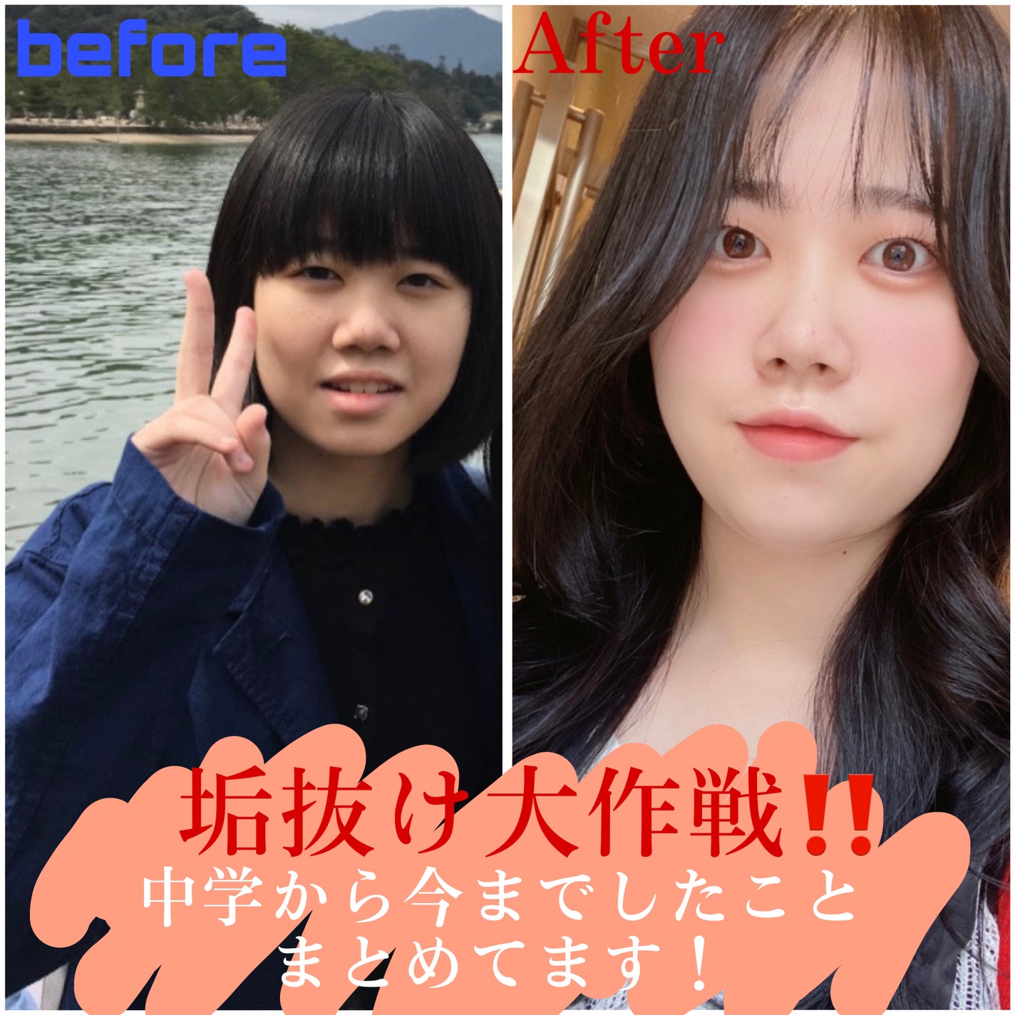 DHC ビタミンCハードカプセル/DHC/美容サプリメントを使ったクチコミ(1枚目)