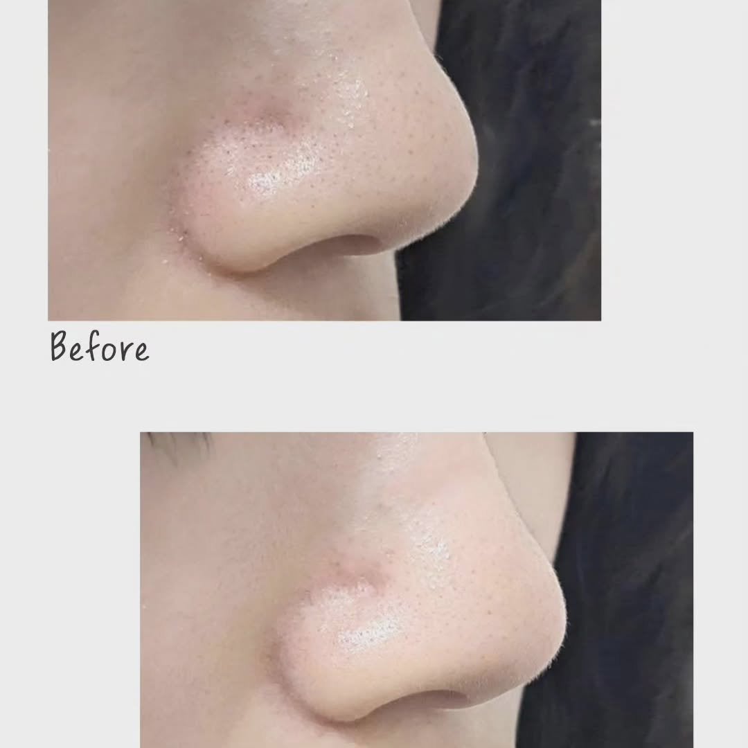 モッチスキン 吸着泡洗顔/MoccHi SKIN/泡洗顔を使ったクチコミ(3枚目)