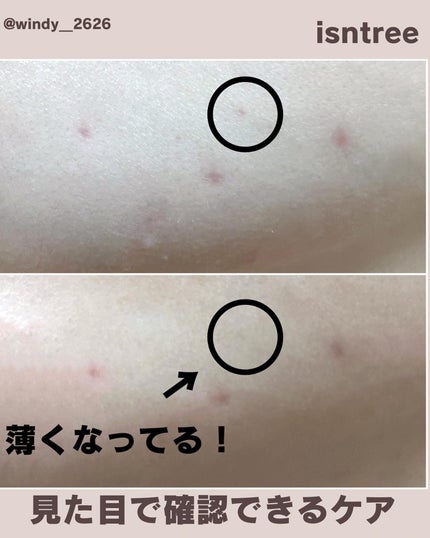 オニオンニューペア B5アンプル/Isntree/美容液を使ったクチコミ(6枚目)