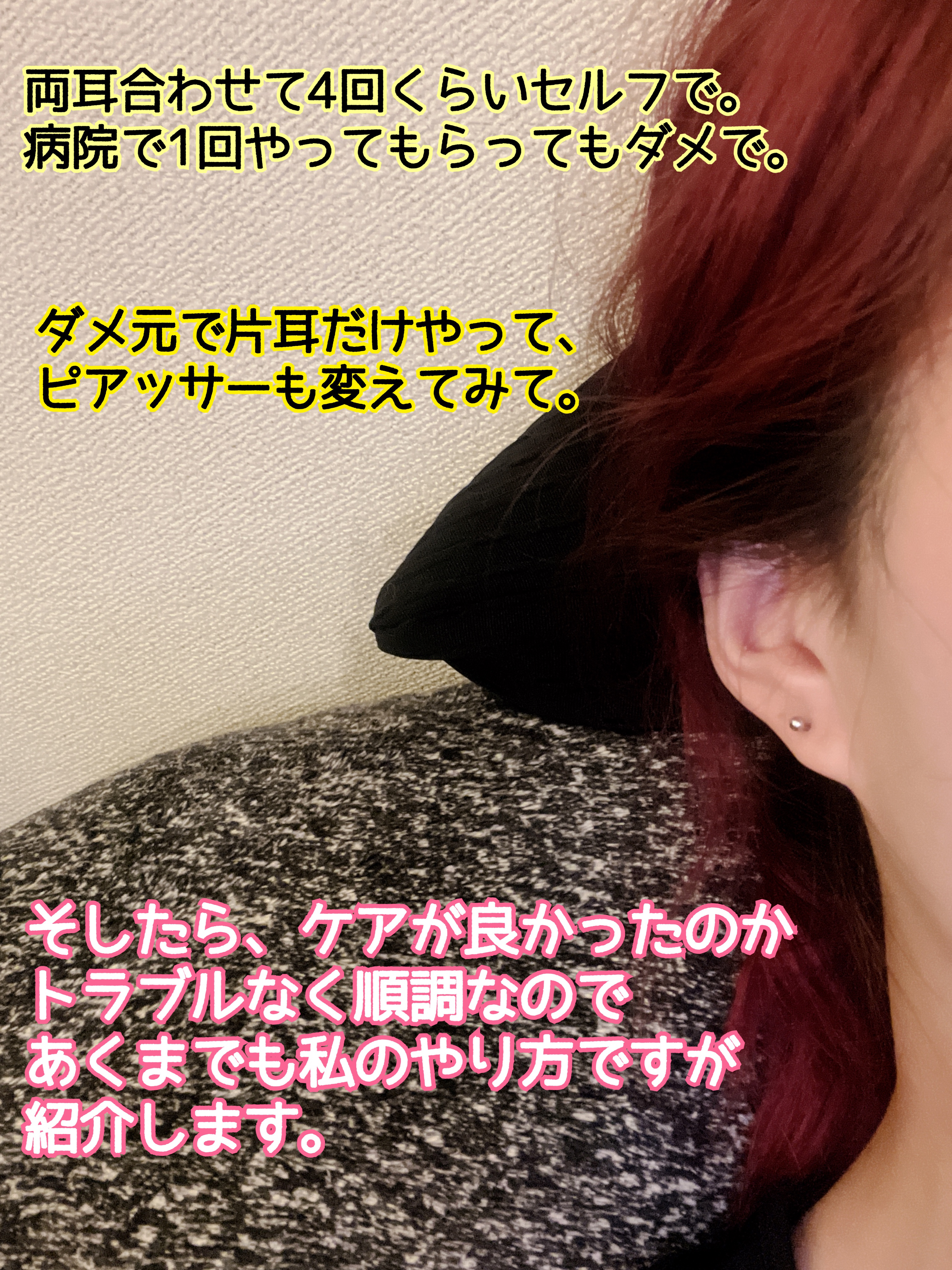 ドルマイシン軟膏(医薬品)/ゼリア新薬工業/その他を使ったクチコミ（2枚目）