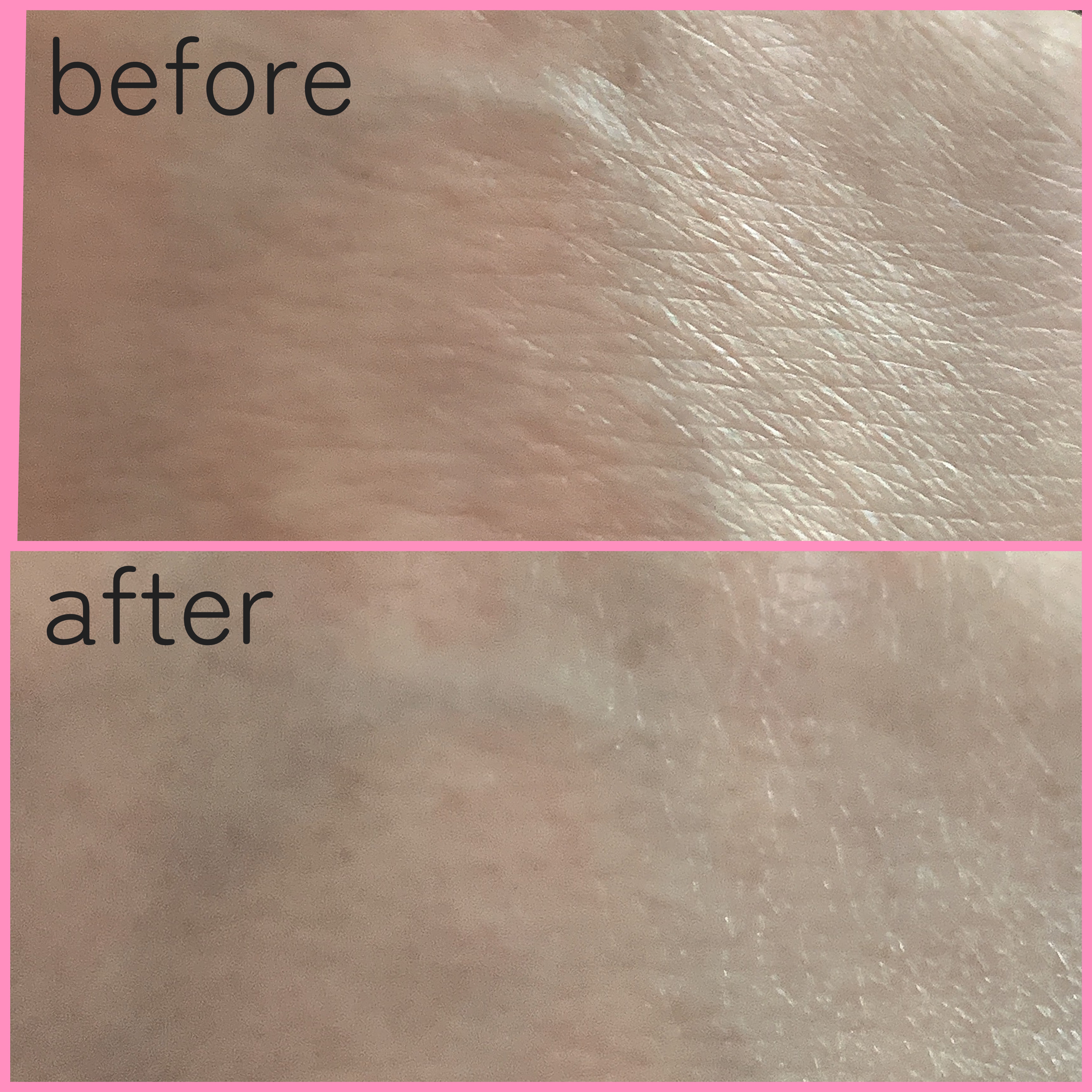 Noni Ampule/celimax/美容液を使ったクチコミ（2枚目）