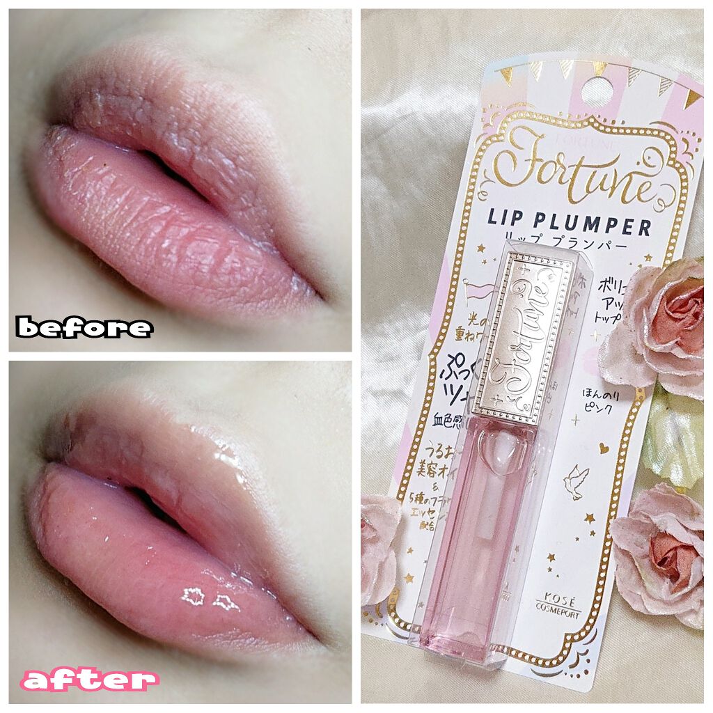リッププランパー/フォーチュン/リッププランパーを使ったクチコミ(1枚目)