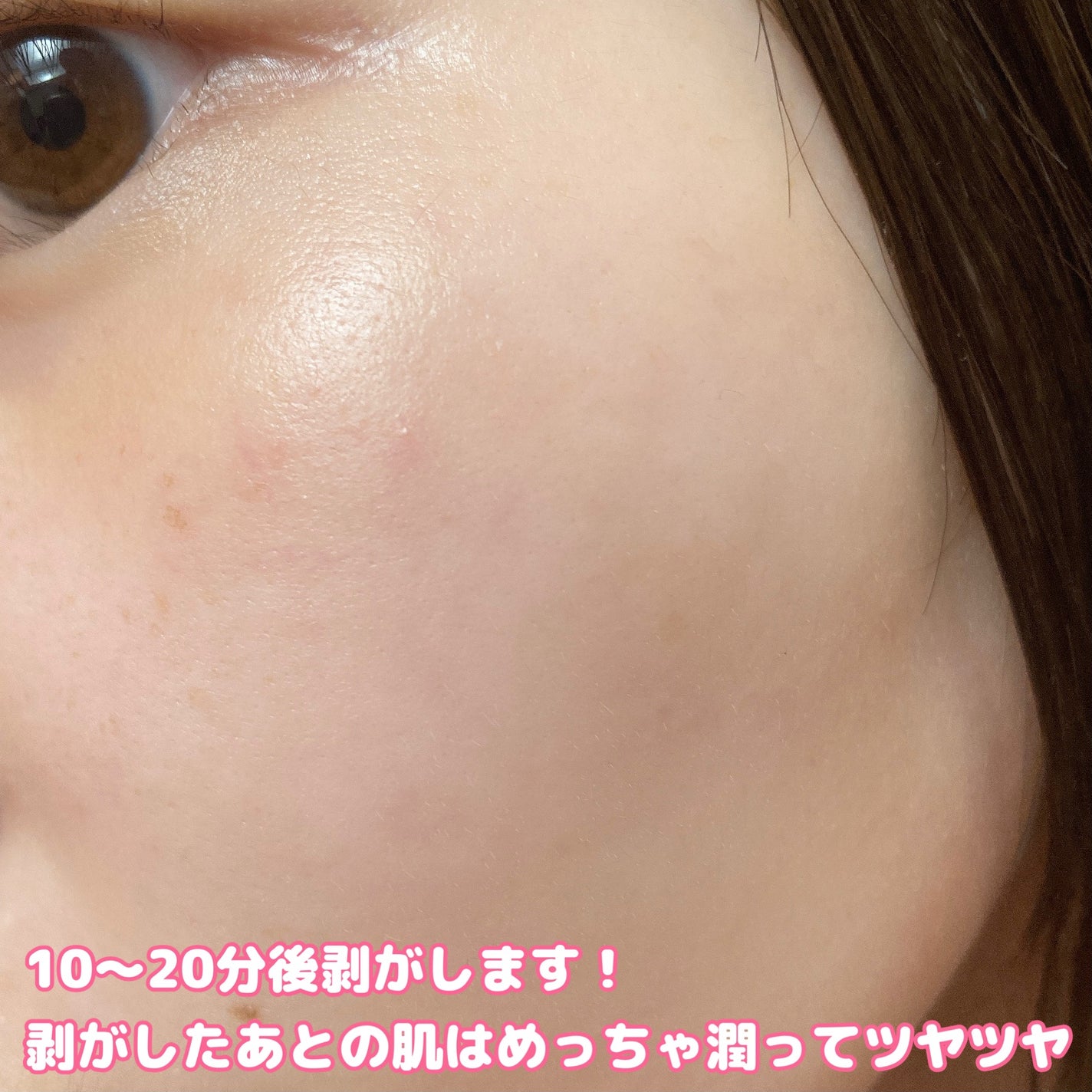 テンションフレックスリラックシングマスク/MEDIHEAL/シートマスク・パックを使ったクチコミ(7枚目)