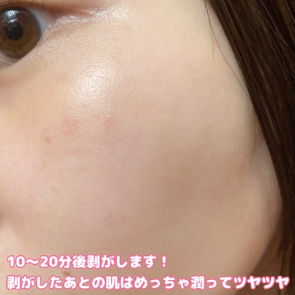 テンションフレックスリラックシングマスク/MEDIHEAL/シートマスク・パックを使ったクチコミ(7枚目)