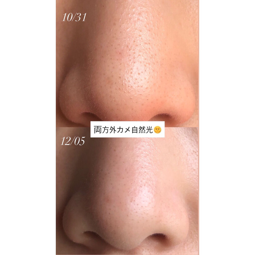 ホホバオイル/無印良品/ボディオイルを使ったクチコミ（3枚目）