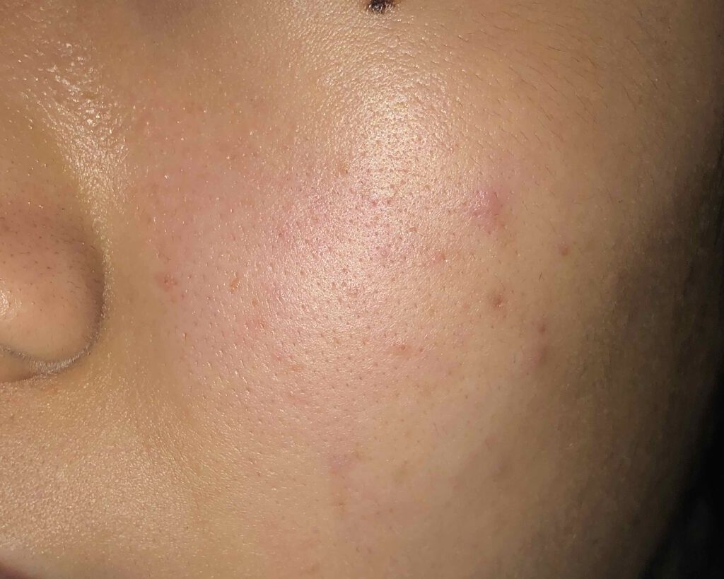 ハトムギ化粧水(ナチュリエ スキンコンディショナー R )/ナチュリエ/化粧水を使ったクチコミ（3枚目）