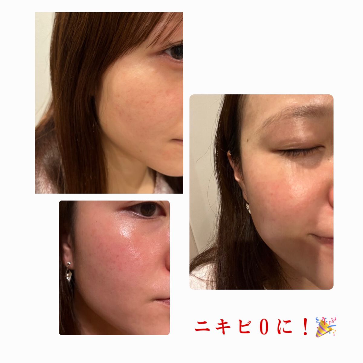 ビフィダシカハーブトナー/manyo/化粧水を使ったクチコミ（3枚目）