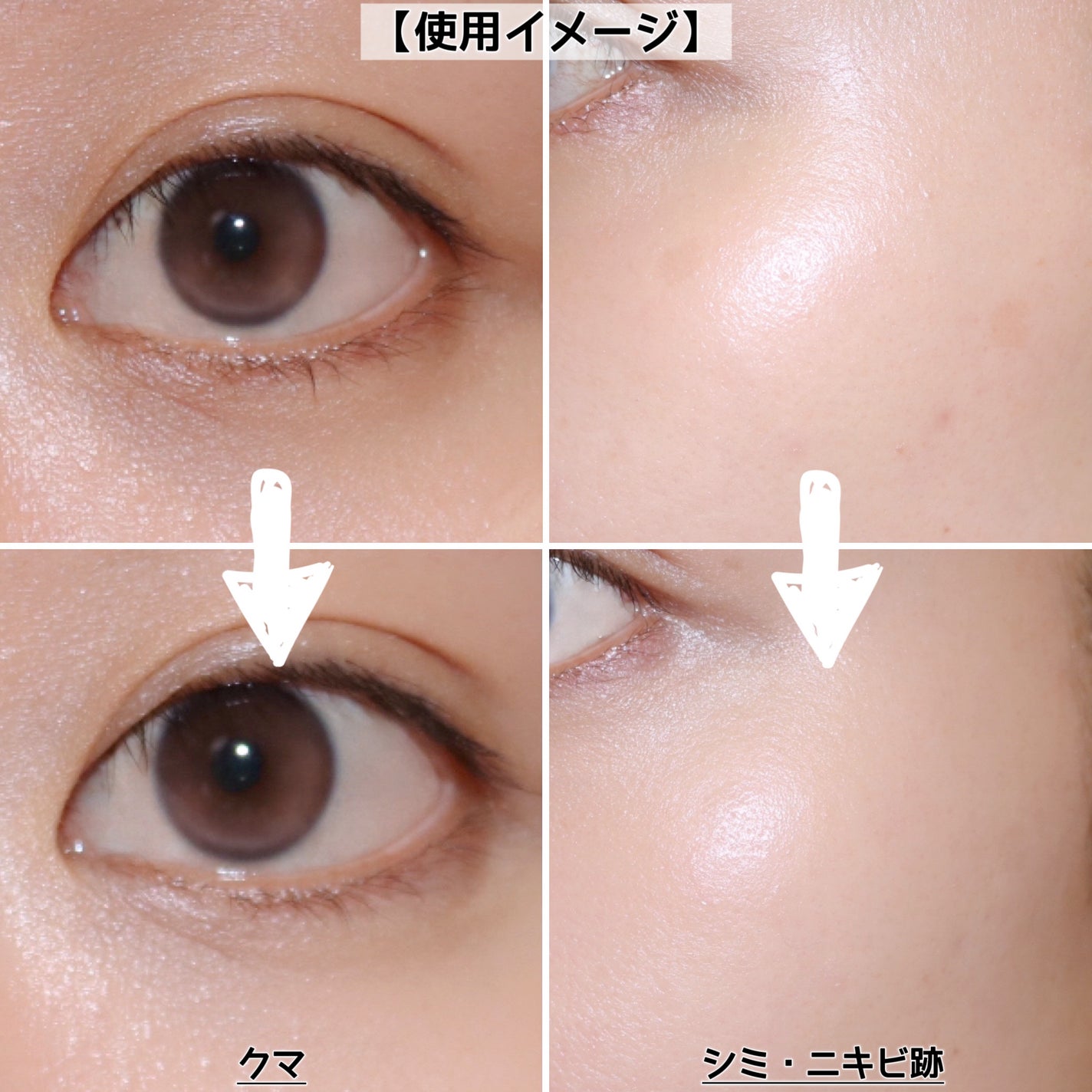 パレットコンシーラー/CandyDoll/パレットコンシーラーを使ったクチコミ(7枚目)