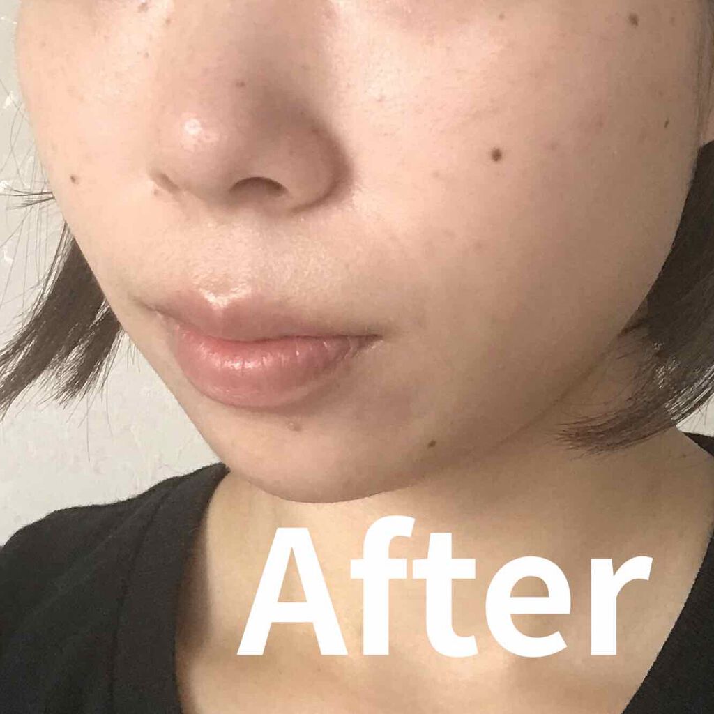 ちゃんり on LIPS 「NeveCrema(ネーヴェクレマ)今韓国・日本で話題のシカク..」(3枚目)