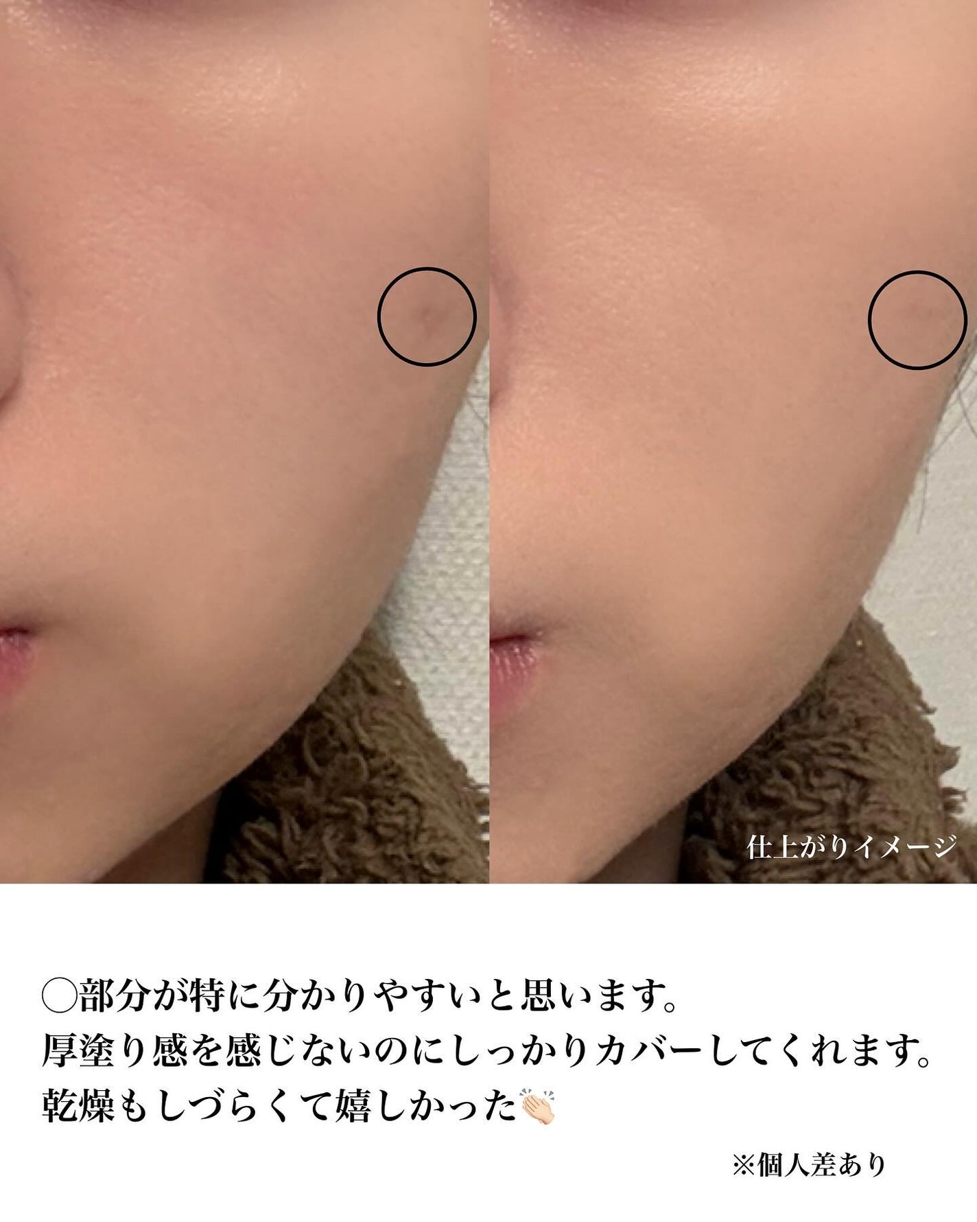 ベイブスキンベイビーブルークッション/unleashia/クッションファンデーションを使ったクチコミ(5枚目)