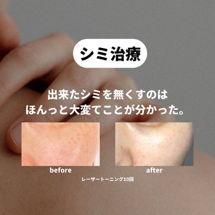 oto|好きを育てるメイクレシピ on LIPS 「美容課金、これはやって良かったというものを🙋内服は実はかなりサ..」(5枚目)