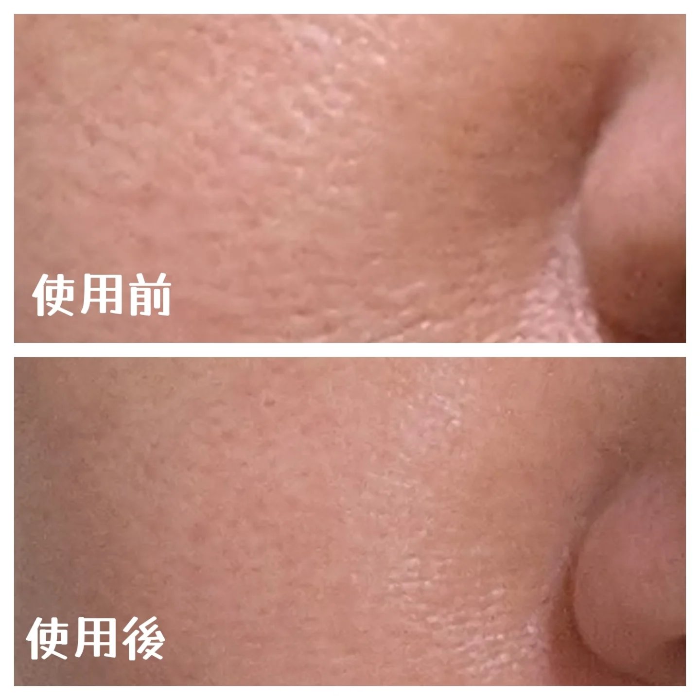 サミュ ガラクトポア セラム/SAM'U/美容液を使ったクチコミ（2枚目）