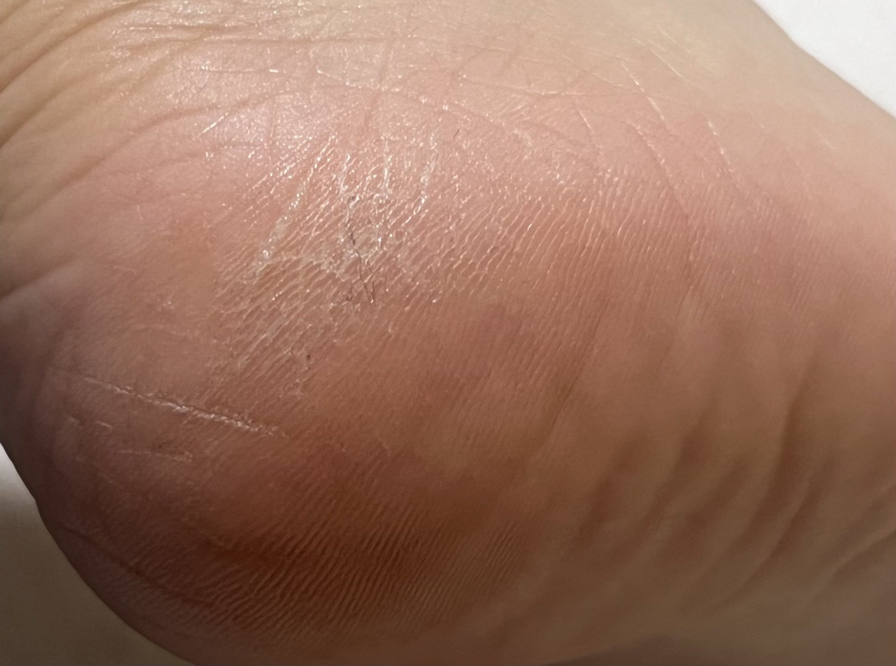 ゴウンバル クリーム/3WB/レッグ・フットケアを使ったクチコミ（3枚目）