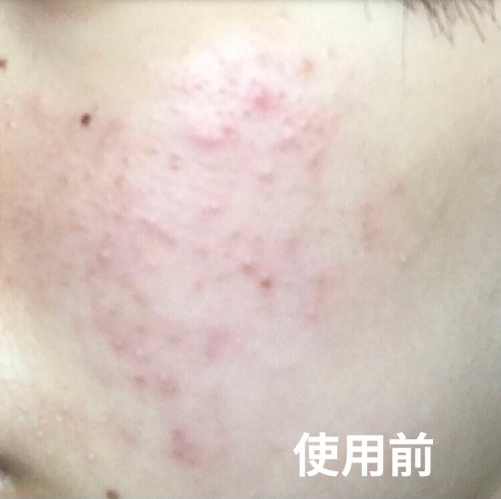 葉月 on LIPS 「おはようございます🔅今話題のシカペアクリーム‼️使ってみたいと..」(2枚目)