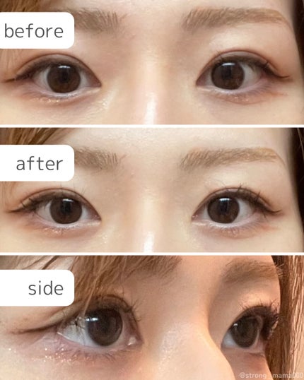 ãã€ããŒãªãããã¹ã«ã©/D-UP/ãã¹ã«ã©ã䜿ã£ãã¯ãã³ãïŒ4æç®ïŒ