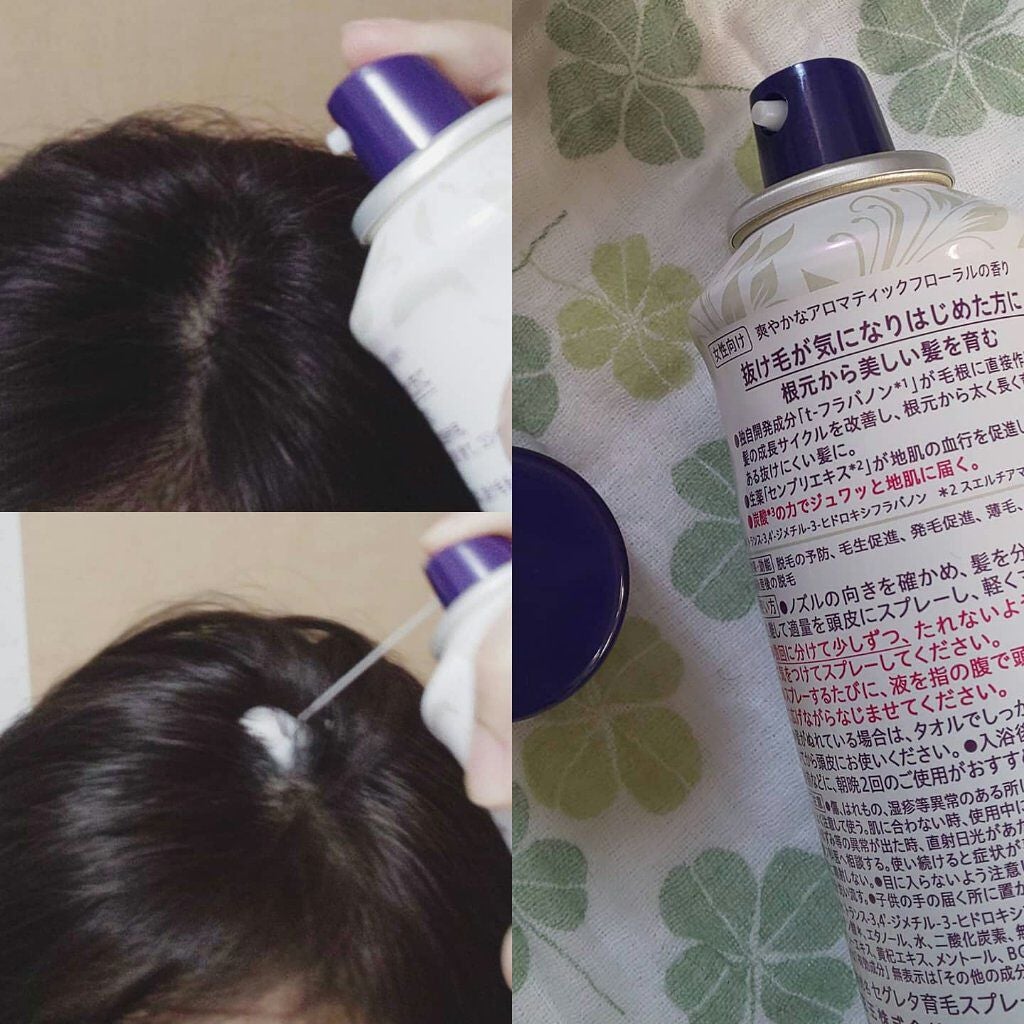 セグレタ髪を育むスプレー/セグレタ/頭皮ローションを使ったクチコミ(1枚目)
