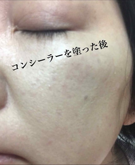 カラー コントローラー/Visée/リキッドコンシーラーを使ったクチコミ(4枚目)
