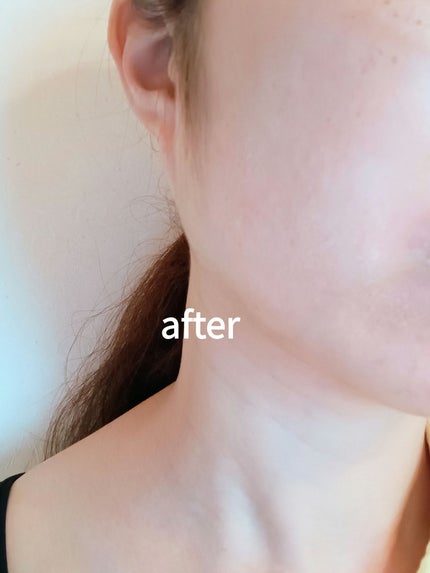 りっちゃん on LIPS 「美白※ケアができる、日焼け止めと美容液のW処方の薬用美容液UV..」(5枚目)