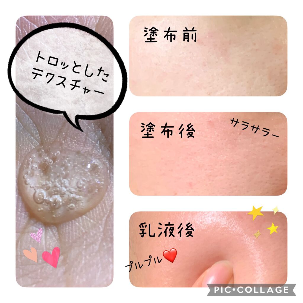 キャビアドットブースター/DEW/ブースター・導入液を使ったクチコミ(3枚目)